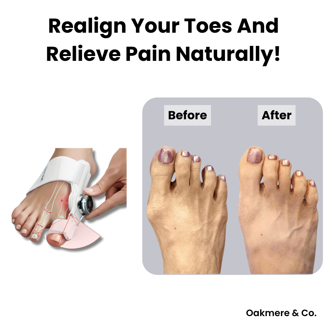 Last Day 50% Off | ToeAlign™ Orthopaedic Bunion Corrector