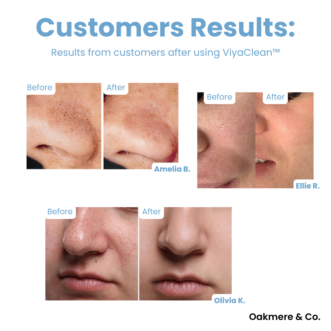 Buy 5, Get 5 Free | ViyaClean™ Pore Cleansing Serum