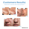 Buy 5, Get 5 Free | ViyaClean™ Pore Cleansing Serum